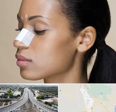 دکتر جراح بینی خانم در اندیمشک