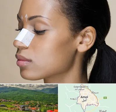 دکتر جراح بینی خانم در آمل