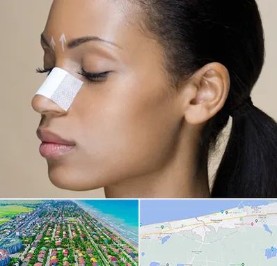 دکتر جراح بینی خانم در فریدونکنار