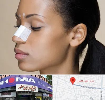 دکتر جراح بینی خانم در امین حضور