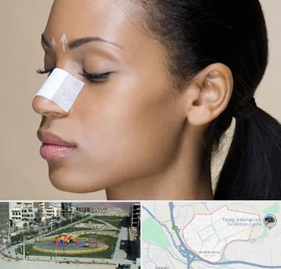 دکتر جراح بینی خانم در مرزداران تبریز