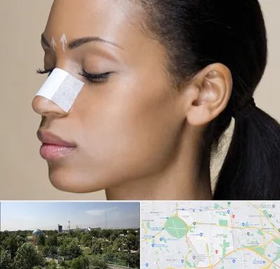 دکتر جراح بینی خانم در منطقه 16 تهران 