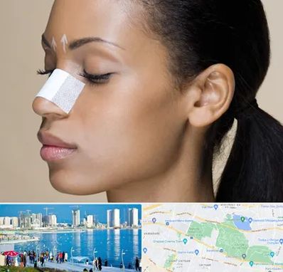 دکتر جراح بینی خانم در چیتگر 