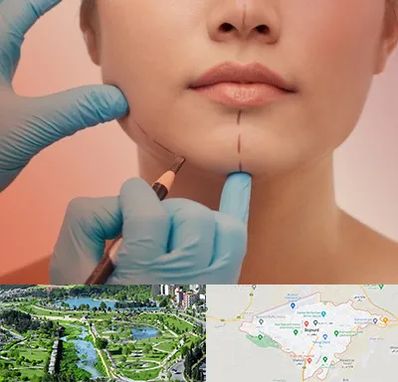 دکتر زیبایی خانم در بجنورد