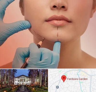 دکتر زیبایی خانم در باغ فردوس