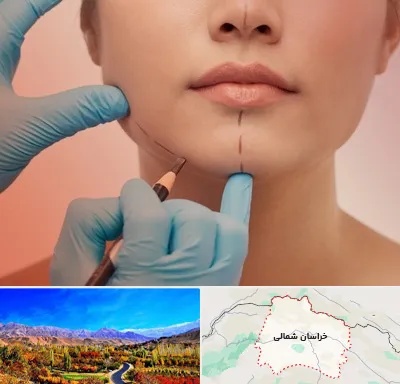 دکتر زیبایی خانم در خراسان شمالی