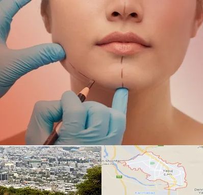 دکتر زیبایی خانم در یاسوج