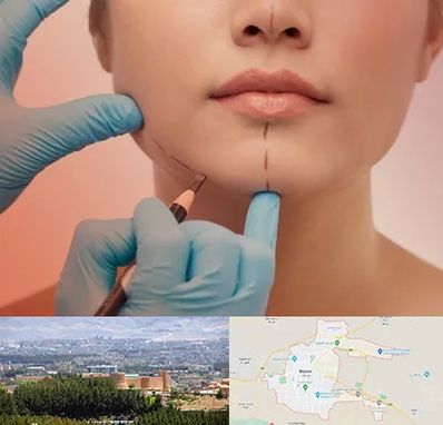 دکتر زیبایی خانم در بیرجند