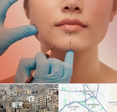 دکتر زیبایی خانم در جنوب شرق تهران