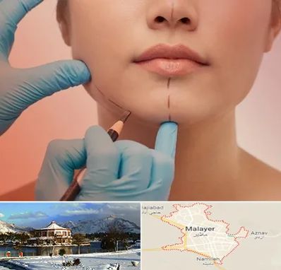 دکتر زیبایی خانم در ملایر