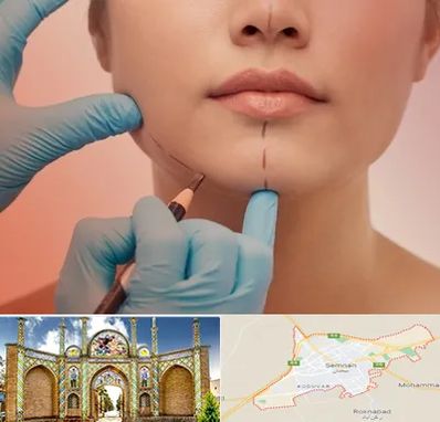 دکتر زیبایی خانم در سمنان