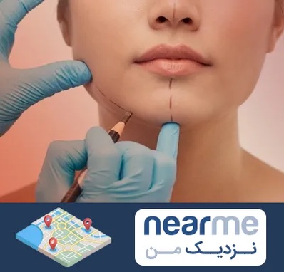 دکتر زیبایی خانم در نزدیک من