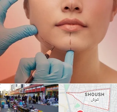 دکتر زیبایی خانم در شوش