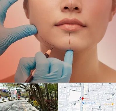 دکتر زیبایی خانم در خیابان توحید اصفهان 