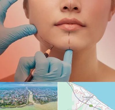 دکتر زیبایی خانم در تنکابن