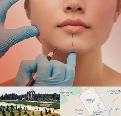 دکتر زیبایی خانم در قرچک