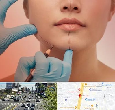 دکتر زیبایی خانم در ستاری 