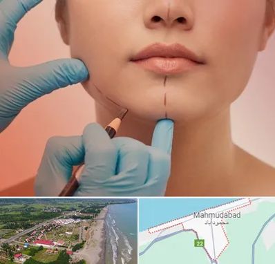 دکتر زیبایی خانم در محمودآباد