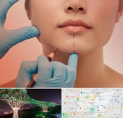 دکتر زیبایی خانم در منطقه 3 تهران 