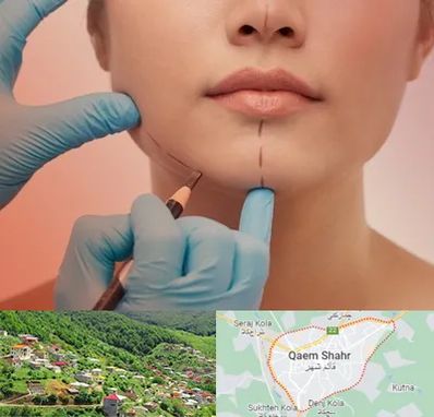 دکتر زیبایی خانم در قائم شهر