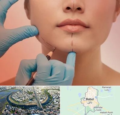 دکتر زیبایی خانم در بابل