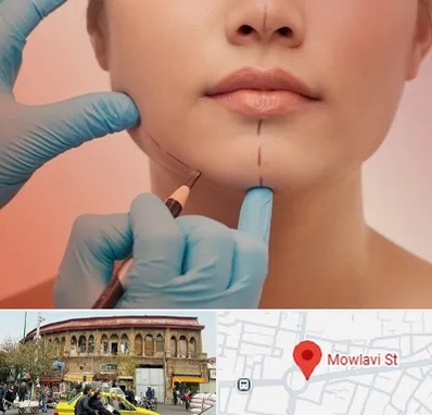 دکتر زیبایی خانم در مولوی