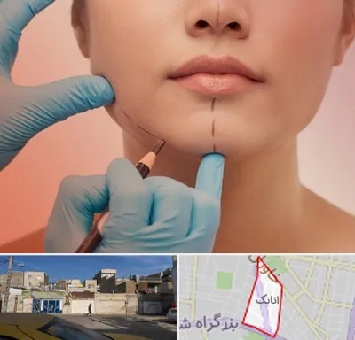 دکتر زیبایی خانم در اتابک