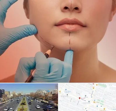 دکتر زیبایی خانم در بلوار معلم مشهد 