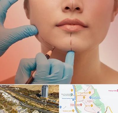 دکتر زیبایی خانم در خیابان نیایش شیراز 