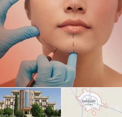دکتر زیبایی خانم در دهدشت