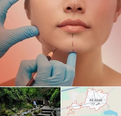 دکتر زیبایی خانم در علی آباد کتول