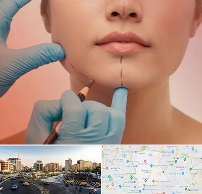 دکتر زیبایی خانم در منطقه 7 تهران 