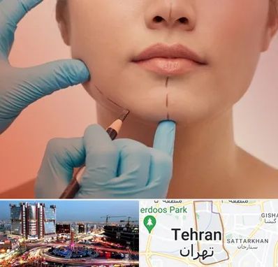 دکتر زیبایی خانم در صادقیه 