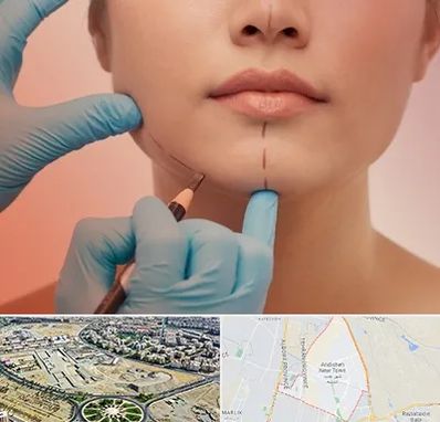 دکتر زیبایی خانم در اندیشه