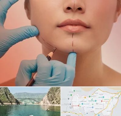 دکتر زیبایی خانم در ایلام