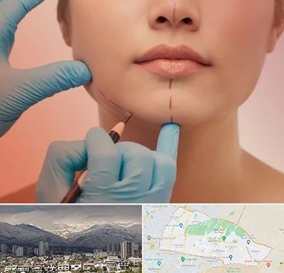 دکتر زیبایی خانم در منطقه 4 تهران 