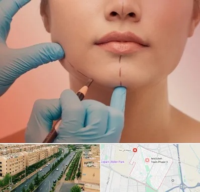دکتر زیبایی خانم در فاز سه اندیشه