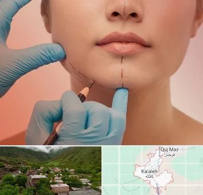 دکتر زیبایی خانم در کلاله