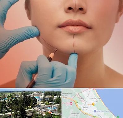 دکتر زیبایی خانم در رودسر