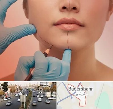 دکتر زیبایی خانم در باقرشهر