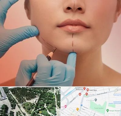 دکتر زیبایی خانم در سالاریه قم