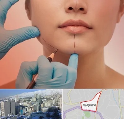 دکتر زیبایی خانم در محمودیه