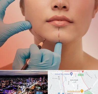 دکتر زیبایی خانم در گلسار رشت 