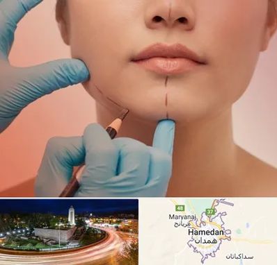 دکتر زیبایی خانم در همدان