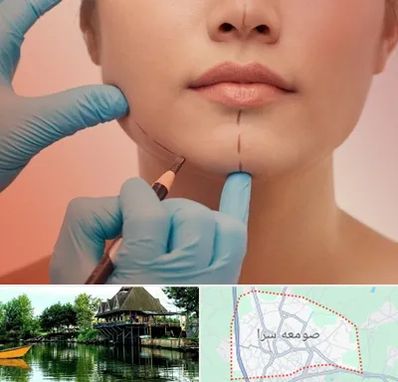 دکتر زیبایی خانم در صومعه سرا