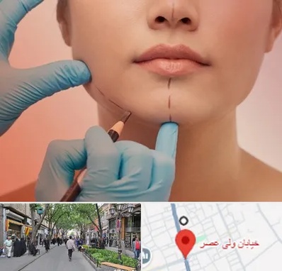 دکتر زیبایی خانم در ولیعصر شهریار