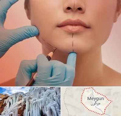 دکتر زیبایی خانم در میگون