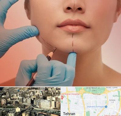 دکتر زیبایی خانم در مرزداران 