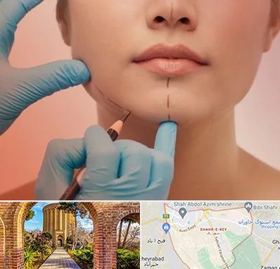 دکتر زیبایی خانم در شهر ری