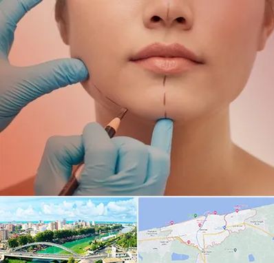دکتر زیبایی خانم در بابلسر